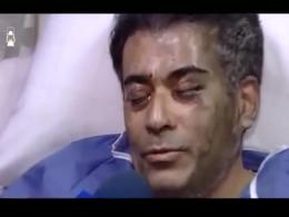 رئیس بیمارستان ضیاییان تهران مورد اسیدپاشی قرار گرفت