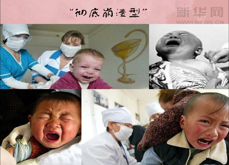 واکسن زدن به نوزاد